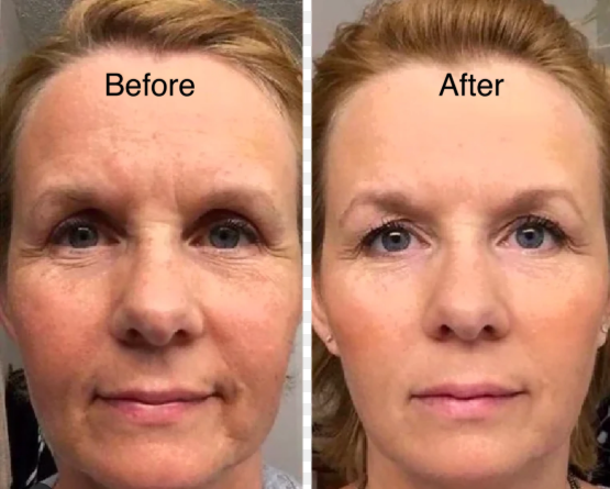 New Face Brush for Sculpting – Anti-Puffiness Detox & Lift Improves Skin Glow.